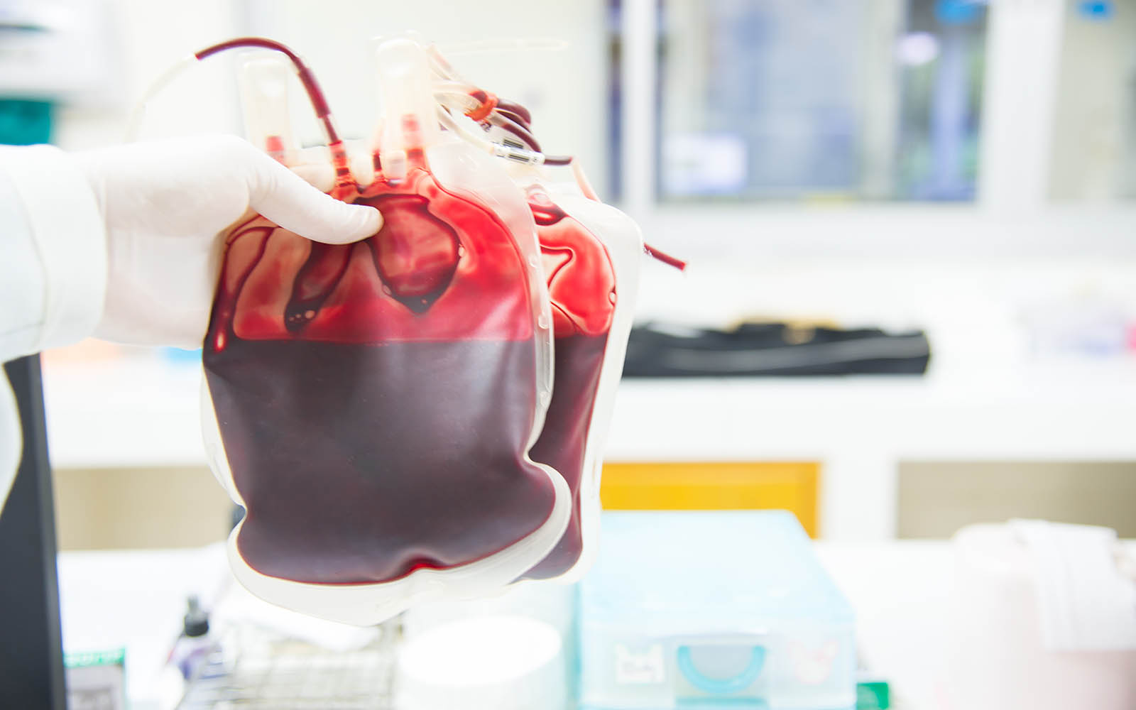 Red,Blood,Bag,In,Hand,Scientist,Over,White,Background,In